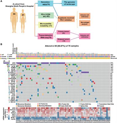 The Immune Landscape of Chinese Head and Neck Adenoid Cystic Carcinoma and Clinical Implication